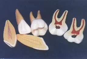 牙齿模具
